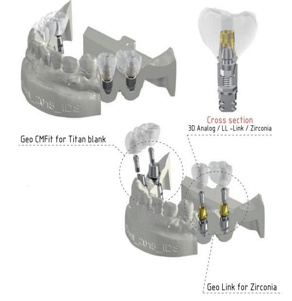 3D Analog Straumann Bone Level -RC Size 4.1/4.8mm (3D-BLR) – Mekong ...