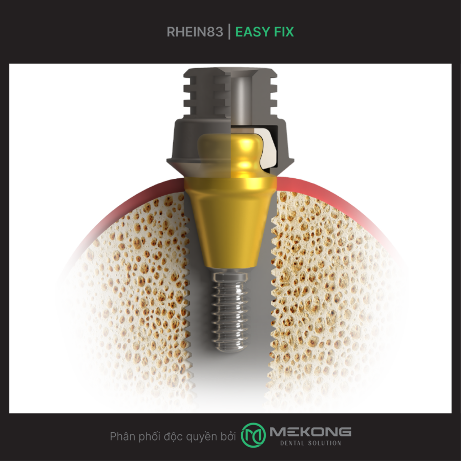 Easy Fix RHEIN83 | Easy Fix