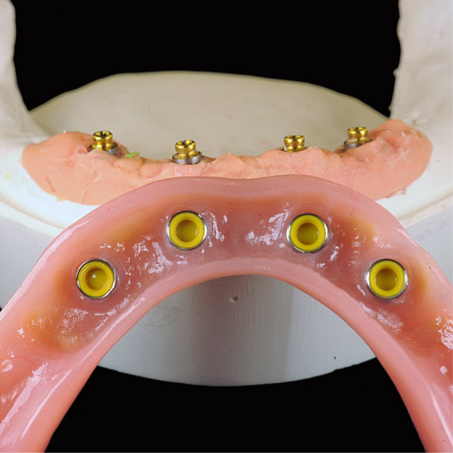 attachment dental, rhein83